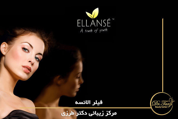 فیلر الانسه