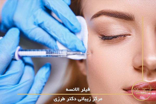 فیلر الانسه