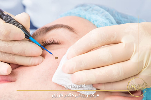 خالبرداری