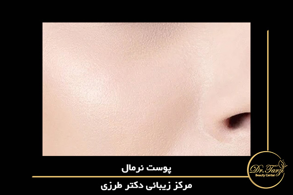 پوست معمولی به خوبی متعادل است: نه خیلی چرب و نه خیلی خشک.