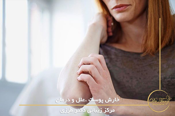 خارش پوست .علل و درمان