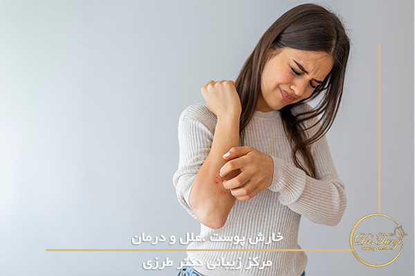 خارش پوست .علل و درمان
