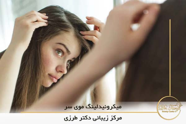 در مورد میکرونیدلینگ موی سر چه میدانید