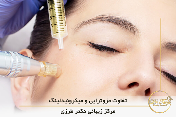 تفاوت مزوتراپی و میکرونیدلینگ
