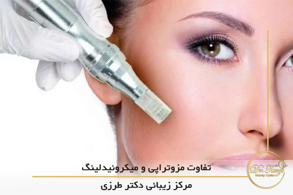 تفاوت مزوتراپی و میکرونیدلینگ