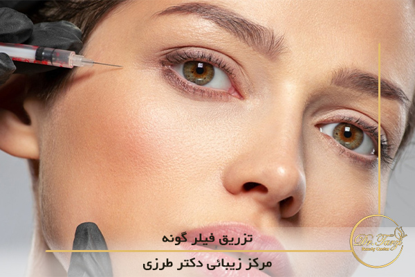 تزریق فیلر شقیقه