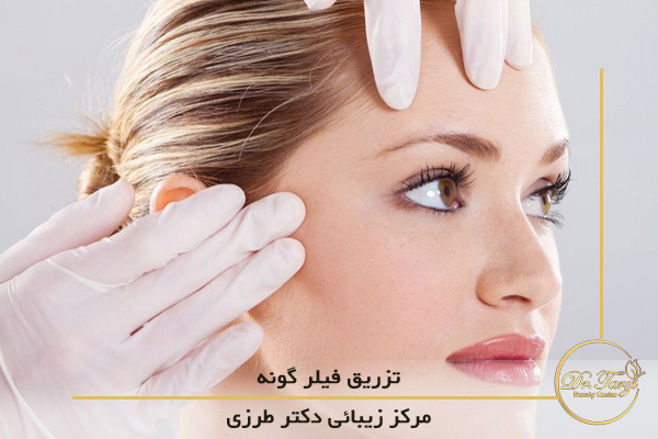 تزریق فیلر شقیقه