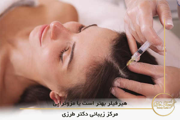 هیرفیلر بهتر است یا مزوتراپی