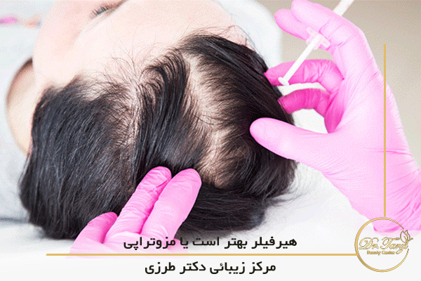 آشنایی با خدمات هیرفیلر و مزوتراپی در کلینیک زیبایی دکتر طرزی