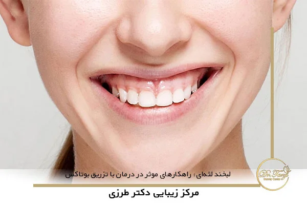 لبخند لثه‌ای: راهکارهای موثر در درمان با تزریق بوتاکس
