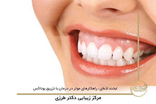 لبخند لثه‌ای: راهکارهای موثر در درمان با تزریق بوتاکس
