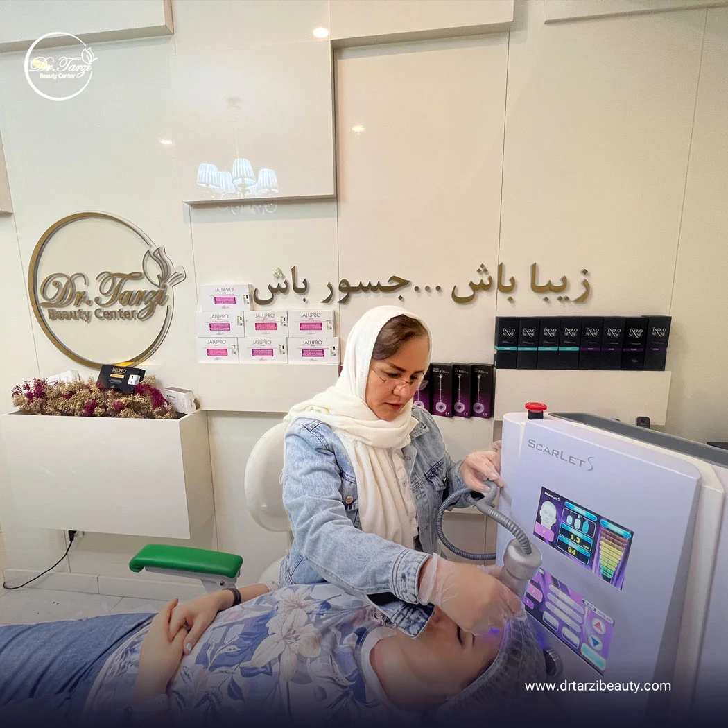 آراف فرکشنال اسکارلت