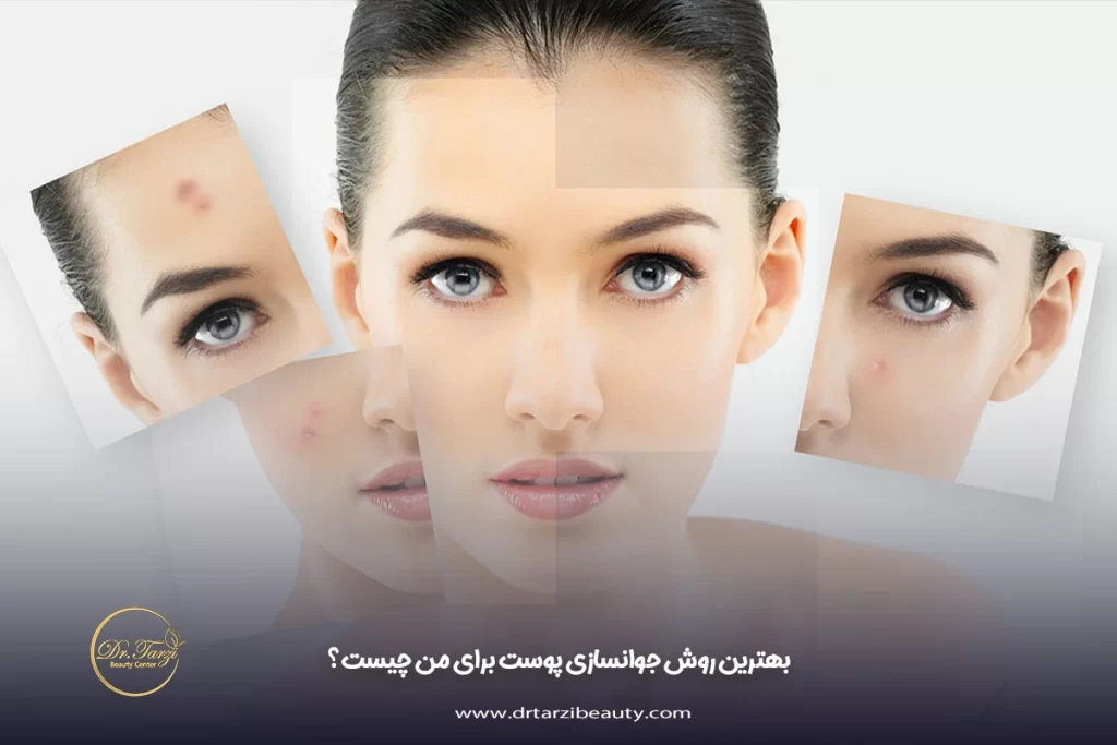 بهترین روش جوانسازی پوست