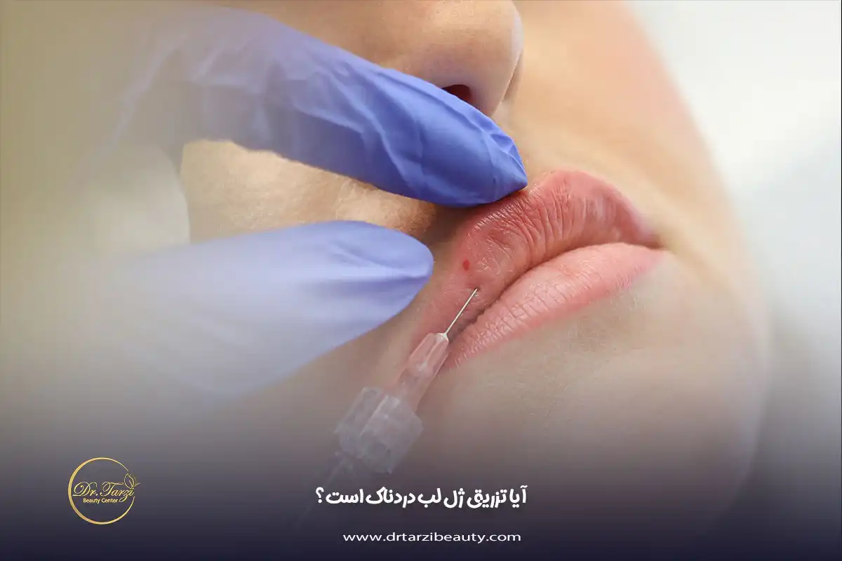آیا تزریق ژل لب دردناک است؟