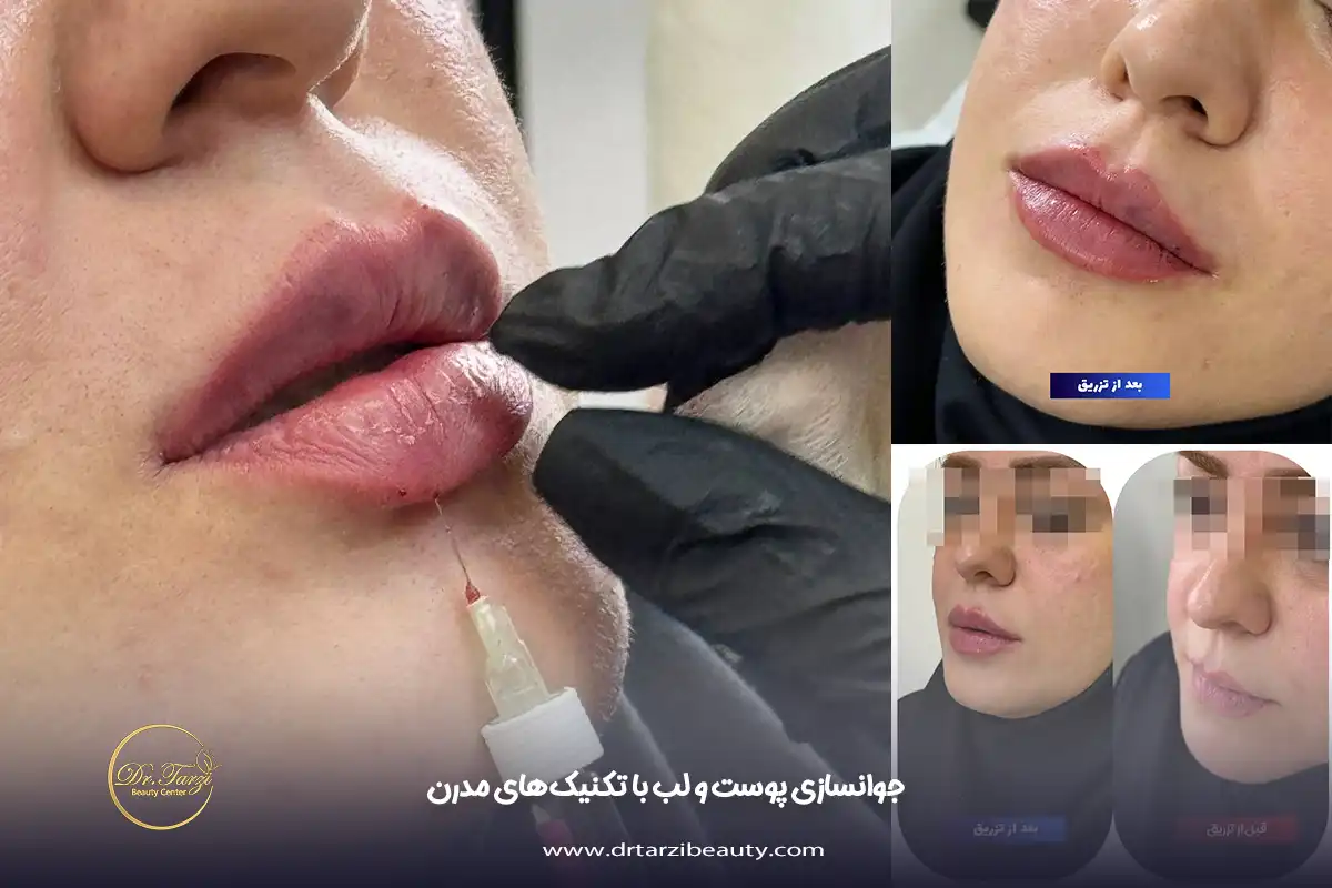 جوانسازی پوست و لب با تکنیک‌های مدرن