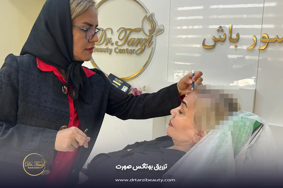 تزریق بوتاکس صورت
