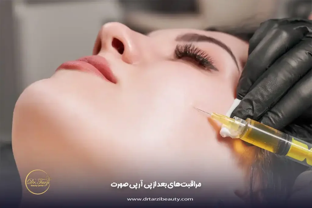 مراقبتهای بعد از پی آر پی صورت