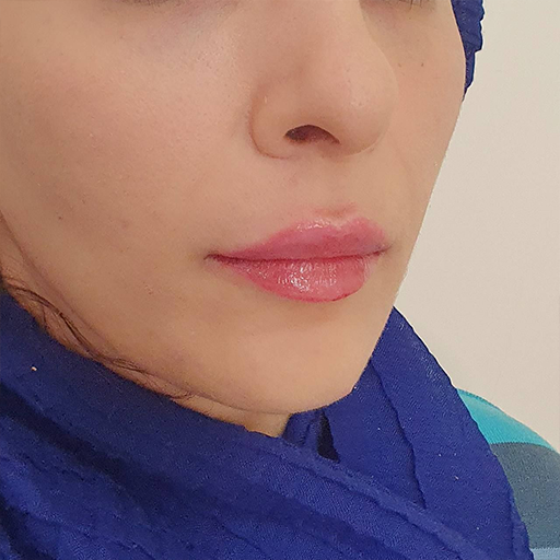 لب نچرال